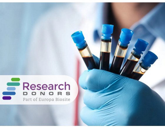 Blut-Bioproben für die Forschung - Vollblut, PBMCs, Leukopaks und mehr