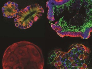 Herzschlag in der Petrischale: Wie Organoide die Forschung revolutionieren