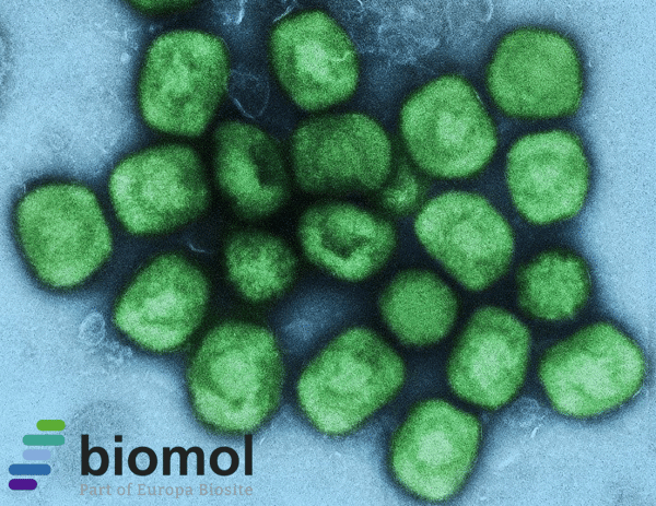 Mpox-Virus – Auf dem Weg zur nächsten Pandemie?