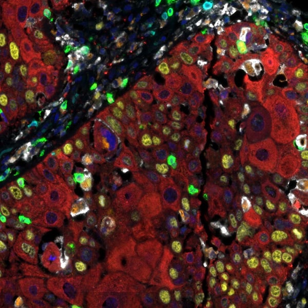 Einführung in die Multiplex Immunhistochemie