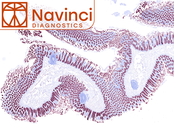 Vollständig automatisierte in situ Proximity-Ligationsassays von Navinci Diagnostics