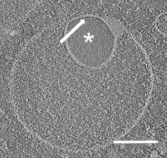 Hemifusom invertierte Form