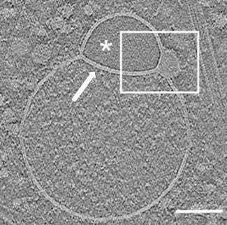 Hemifusom direkte Form