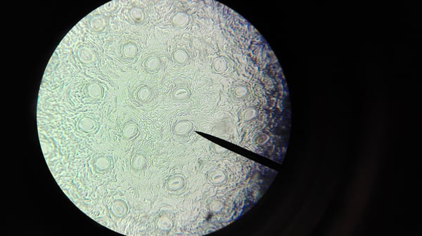 Vom Mikroskop zur Organelle - Die Entdeckung des Hemifusoms