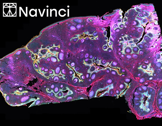 Naveni® Plex Omni Service – Die Zukunft der räumlichen Interaktomik