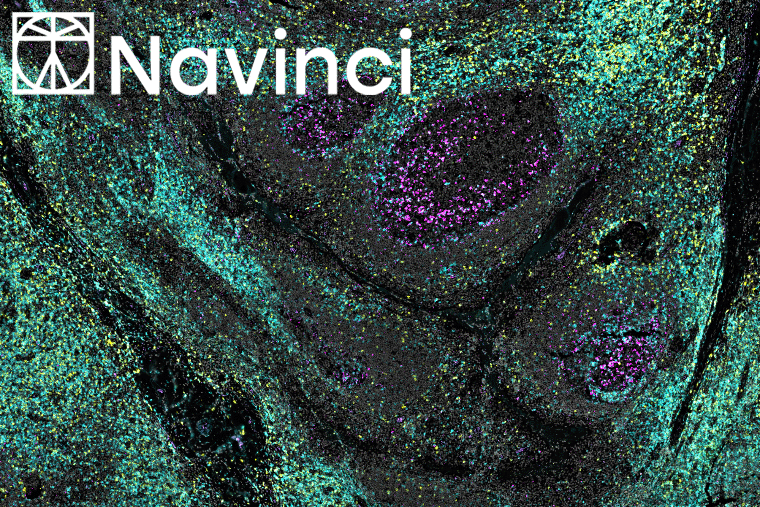 Wer mit wem? Proteinbeziehungen sichtbar machen mit Naveni® Plex von Navinci