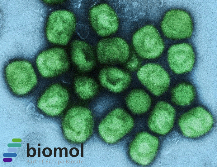 Mpox-Virus – Auf dem Weg zur nächsten Pandemie?