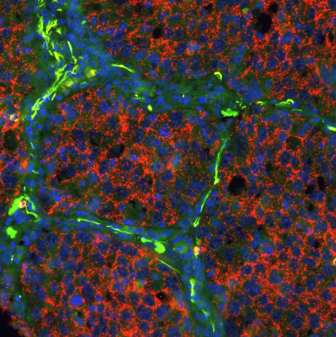 Proximity Ligation: Eine revolutionäre Technologie zum Nachweis von Proteinen
