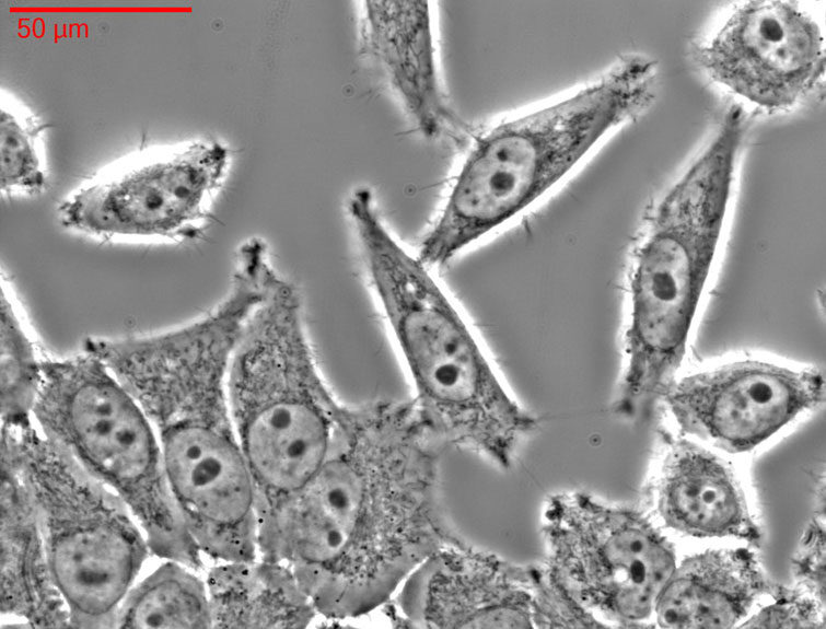 Henrietta Lacks' unsterbliche Zellen