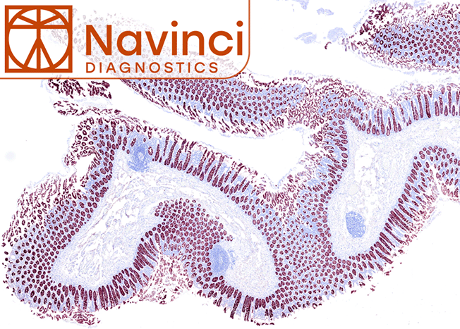Vollständig automatisierte in situ Proximity-Ligationsassays von Navinci Diagnostics