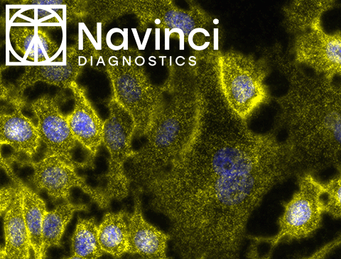 Neu: NaveniFlex Cell und NaveniFlex Tissue von Navinci Diagnostics
