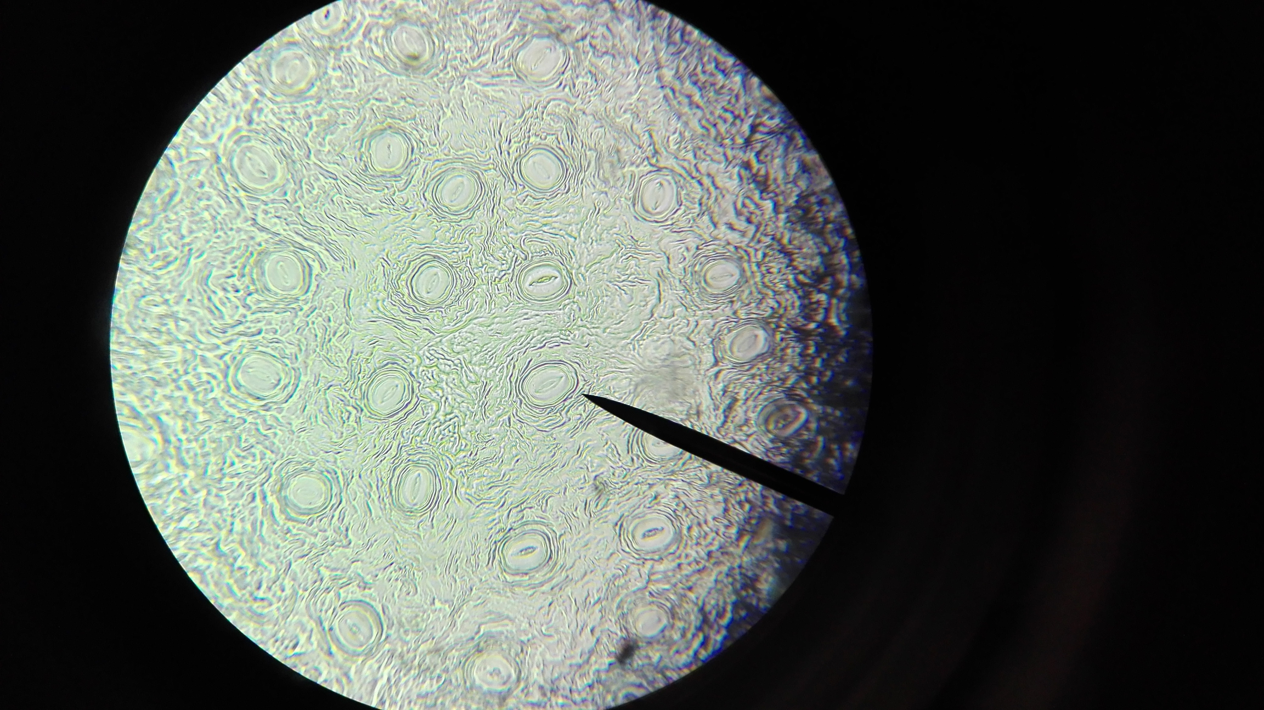 Vom Mikroskop zur Organelle - Die Entdeckung des Hemifusoms